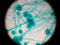 Аспергилл Aspergilus W.M.