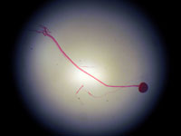  Rhizopus W.M.