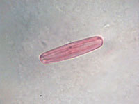 Клостериум Closterium Sp W.M