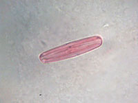  Closterium Sp W.M