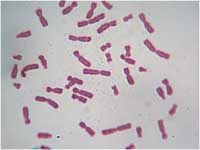 Хромосомы человека (женские) Human Chromosome (Female)