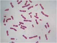   () Human Chromosome (Female)