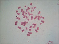 Хромосомы человека (мужские) Human Chromosome (Мale)